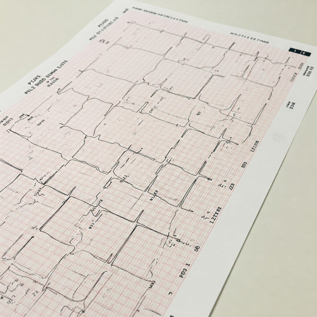 Electrocardiógrafo de 12 derivaciones